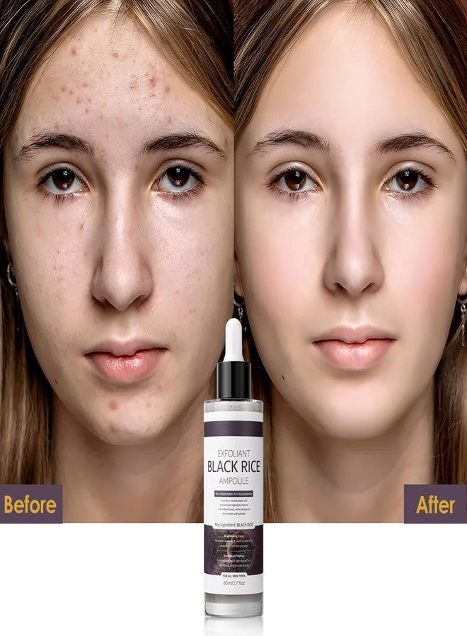 Veakoo Peel Shot Glow Black Rice Exfoliant Peeling Ampoule, Soft Exfoliating Brightening Serum, Face and Body Scrub, Facial Exfoliator, Deep Hydration, 80ml - Image 4